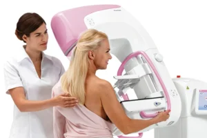 planmed-digital-mammography-m