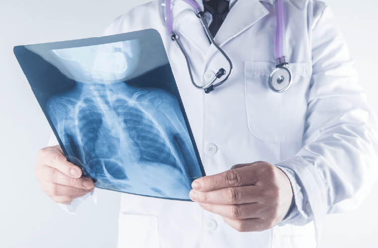xray