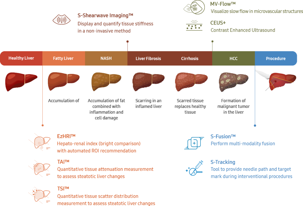 Liver Elastography & Quantification (Fibroscan) - Dr. Dua's Diagnostics