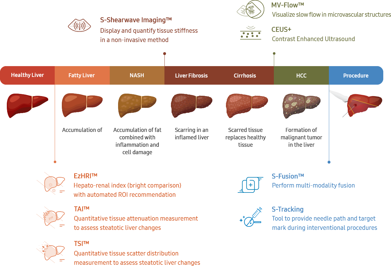 Liver Graph Liver Elastography & Quantification (Fibroscan) - Dr. Dua's Diagnostics