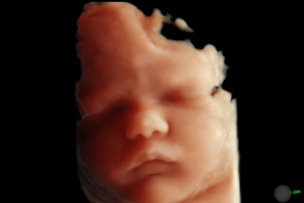 3D 4D fetal ultrasound imaging at Dr. Dua Diagnostics Chandigarh