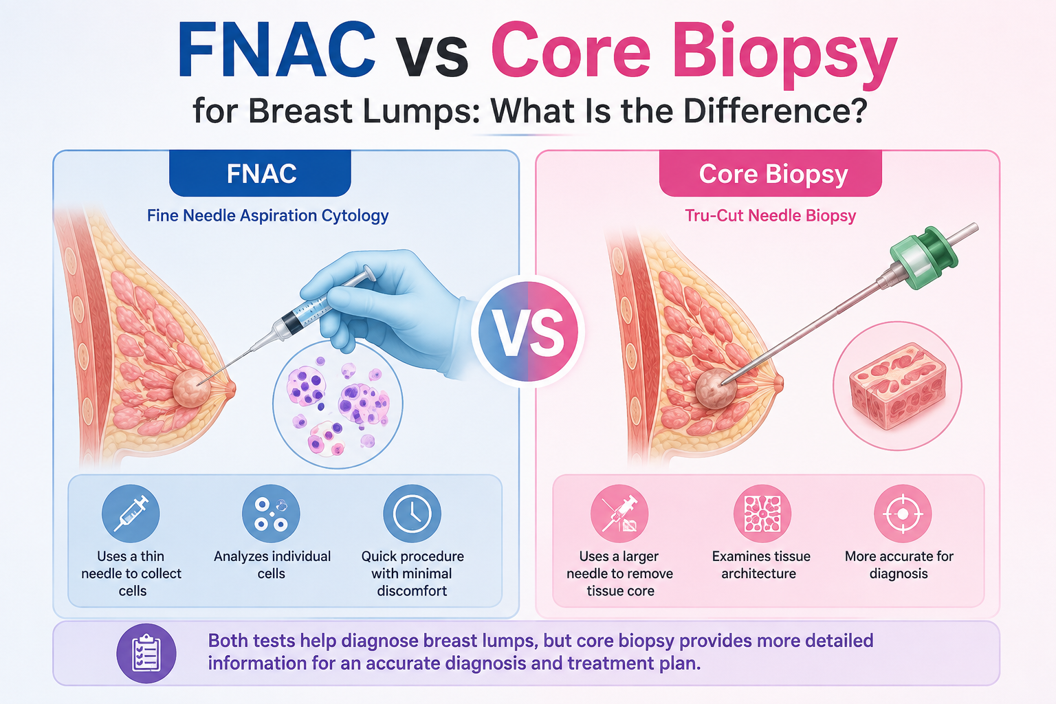 FNAC vs Core Biopsy for Breast Lumps: What Is the Difference?